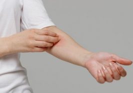 Ilustrasi gatal (Foto: Pinterest)