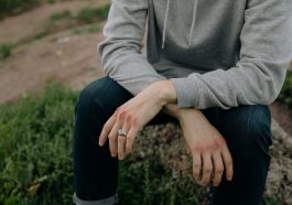 Alasan mengapa memar di tubuh punya warna yang berbeda-beda.