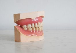 Alasan mengapa gigi menjadi kuning.